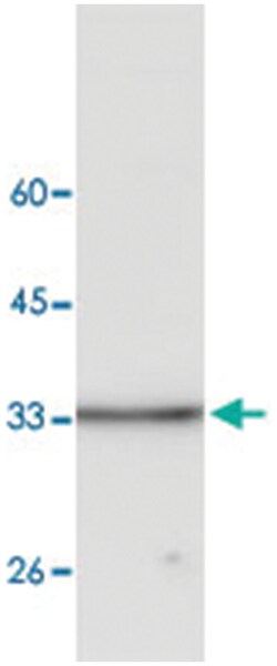 AKR1B1, Mouse, Clone: 19, Abnova 100&mu;g; Unlabeled:Antibodies, Monoclonal