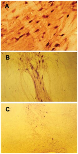Dopamine, Rabbit, Polyclonal Antibody, Abnova 100 &mu;L | Buy Online | Abnova Corporation | Fisher Scientific