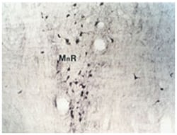 tryptamine, Rabbit, Polyclonal Antibody, Abnova 100 &mu;L | Buy Online | Abnova Corporation | Fisher Scientific