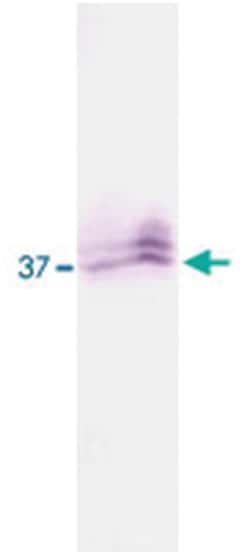 KLK5 Rabbit anti-Human, Polyclonal Antibody, Abnova 200 &mu;L | Buy Online | Abnova Corporation | Fisher Scientific