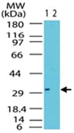 RAX, Rabbit, Polyclonal Antibody, Abnova 100&mu;g; Unlabeled:Antibodies,