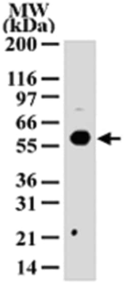 HDAC1 Rabbit anti-Human, Polyclonal Antibody, Abnova 100&mu;g; Unlabeled:Antibodies,