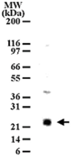 LY86 Rabbit anti-Human, Mouse, Polyclonal Antibody, Abnova 100&mu;g; Unlabeled:Antibodies,