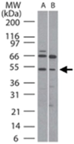 RUNX1 Rabbit anti-Human, Mouse, Polyclonal Antibody, Abnova 100 &mu;g | Buy Online | Abnova | Fisher Scientific