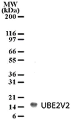 UBE2V2, Rabbit, Polyclonal Antibody, Abnova 100&mu;g; Unlabeled:Antibodies,