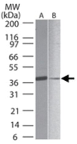 SIRT7 Rabbit anti-Human, Polyclonal Antibody, Abnova 100&mu;g; Unlabeled:Antibodies,