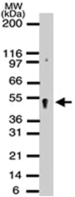 APEX2, Rabbit, Polyclonal Antibody, Abnova 200&mu;L; Unlabeled:Antibodies,