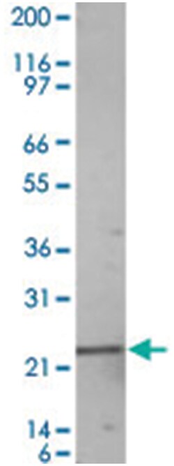 RGS2, Rabbit, Polyclonal Antibody, Abnova 100 &mu;g | Buy Online | Abnova Corporation | Fisher Scientific