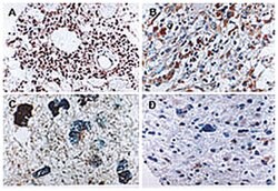 CASP6 Rabbit anti-Dog, Gerbils, Human, Mouse, Rat, Polyclonal Antibody, Abnova 50 &mu;L | Buy Online | Abnova Corporation | Fisher Scientific