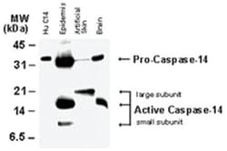 CASP14 Rabbit anti-Dog, Gerbils, Human, Mouse, Rat, Polyclonal Antibody, Abnova 50 &mu;L | Buy Online | Abnova | Fisher Scientific