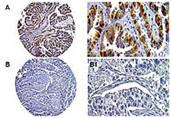 CASP14 Rabbit anti-Dog, Gerbils, Human, Mouse, Rat, Polyclonal Antibody, Abnova 50 &mu;L | Buy Online | Abnova | Fisher Scientific