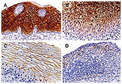 CASP14 Rabbit anti-Dog, Gerbils, Human, Mouse, Rat, Polyclonal Antibody, Abnova 50 &mu;L | Buy Online | Abnova | Fisher Scientific