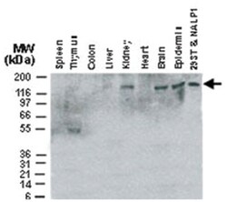 NLRP1 Rabbit anti-Human, Polyclonal Antibody, Abnova 50&mu;L; Unlabeled:Antibodies,