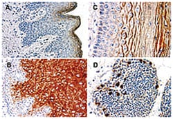 NLRP1 Rabbit anti-Human, Polyclonal Antibody, Abnova 50&mu;L; Unlabeled:Antibodies,