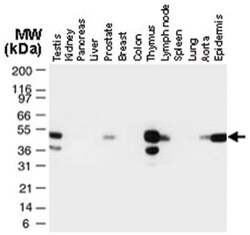 TRAF1 Rabbit anti-Human, Polyclonal Antibody, Abnova 50 &mu;L | Buy Online | Abnova | Fisher Scientific