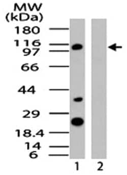 IPO8, Rabbit, Polyclonal Antibody, Abnova 100&mu;g; Unlabeled:Antibodies,