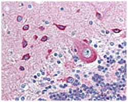 PACSIN2 Rabbit anti-Chimpanzee, Clawed frog, Human, Polyclonal Antibody, Abnova 100 &mu;g | Buy Online | Abnova | Fisher Scientific