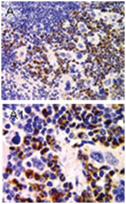 PYDC1, Rabbit, Polyclonal Antibody, Abnova 50 &mu;L | Buy Online | Abnova Corporation | Fisher Scientific