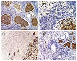 PYDC1, Rabbit, Polyclonal Antibody, Abnova 50 &mu;L | Buy Online | Abnova Corporation | Fisher Scientific