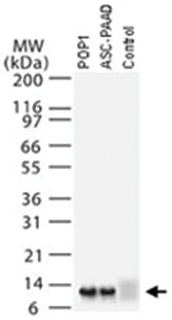 PYDC1, Rabbit, Polyclonal Antibody, Abnova 50 &mu;L | Buy Online | Abnova Corporation | Fisher Scientific