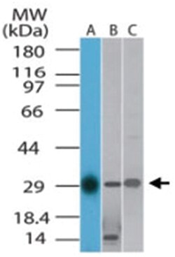 TLX1 Rabbit anti-Human, Mouse, Rat, Polyclonal Antibody, Abnova 100 &mu;g | Buy Online | Abnova | Fisher Scientific