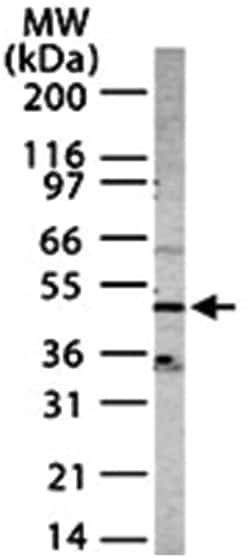 CXCR4 Rabbit anti-Human, Mouse, Rat, Polyclonal Antibody, Abnova 100&mu;g;