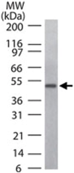 CD4 Rabbit anti-Chimpanzee, Human, Polyclonal Antibody, Abnova