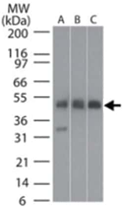 TUBB2A, Rabbit, Polyclonal Antibody, Abnova 100&mu;g; Unlabeled:Antibodies,