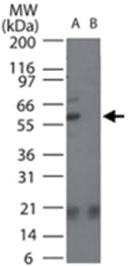 SMAD2 Rabbit anti-Bovine, Chicken, Chimpanzee, Dog, Human, Mouse, Rat,