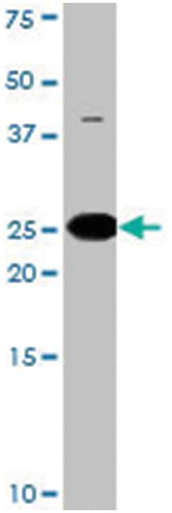 BAD (phospho S134), Rabbit anti-Human, Polyclonal Antibody, Abnova 400 &mu;L | Buy Online | Abnova | Fisher Scientific