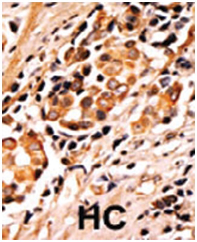 ANTIBAD ANTIBODY 400UL