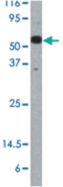 CDC25A (phospho S124), Rabbit anti-Human, Polyclonal Antibody, Abnova 400&mu;L;