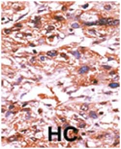 CDC25A (phospho S124), Rabbit anti-Human, Polyclonal Antibody, Abnova 400&mu;L;