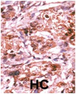 CDC25A (phospho S293), Rabbit anti-Human, Polyclonal Antibody, Abnova 400&mu;L;