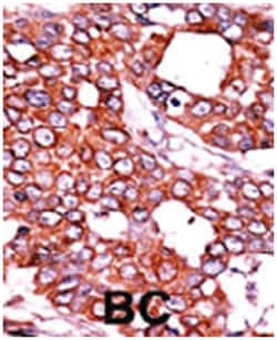 CDC25A (phospho T507), Rabbit anti-Human, Polyclonal Antibody, Abnova 400&mu;L;