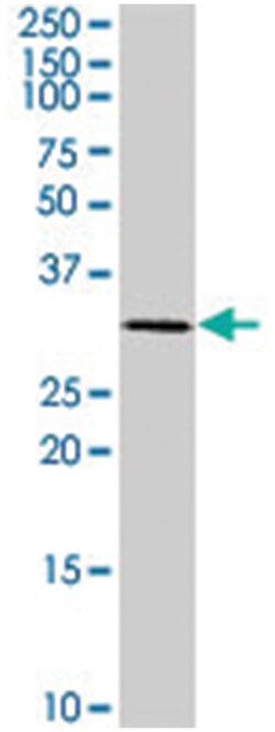 CDC2 (phospho S39), Rabbit anti-Human, Polyclonal Antibody, Abnova 400&mu;L;