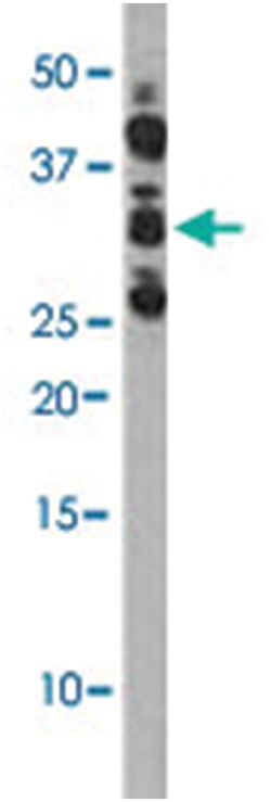 CDC2 (phospho S39), Rabbit anti-Human, Polyclonal Antibody, Abnova 400&mu;L;