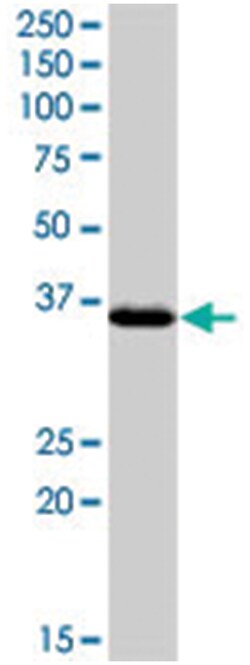 CDK7 (phospho T170), Rabbit anti-Human, Polyclonal Antibody, Abnova 400&mu;L;