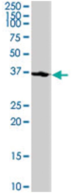 CDK7 (phospho T170), Rabbit anti-Human, Polyclonal Antibody, Abnova 400&mu;L;