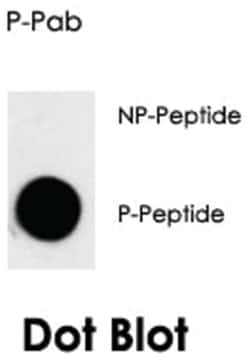 CDK7 (phospho T170), Rabbit anti-Human, Polyclonal Antibody, Abnova 400&mu;L;
