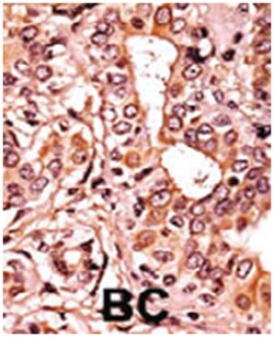 CDK7 (phospho T170), Rabbit anti-Human, Polyclonal Antibody, Abnova 400&mu;L;