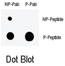 CHEK1 (phospho S317), Rabbit anti-Human, Polyclonal Antibody, Abnova 400&mu;L;