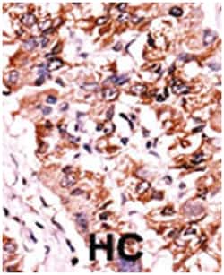 CHEK1 (phospho S317), Rabbit anti-Human, Polyclonal Antibody, Abnova 400&mu;L;