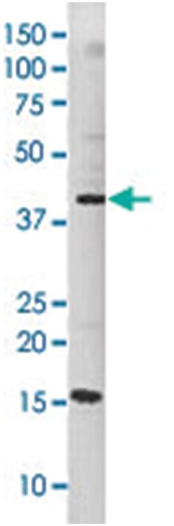 JUN (phospho S63), Rabbit anti-Human, Polyclonal Antibody, Abnova 400&mu;L;