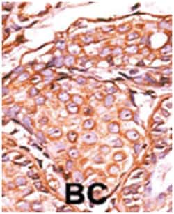 JUN (phospho S63), Rabbit anti-Human, Polyclonal Antibody, Abnova 400&mu;L;