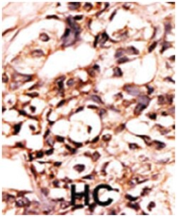 DAXX (phospho S213), Rabbit anti-Human, Polyclonal Antibody, Abnova 400&mu;L;