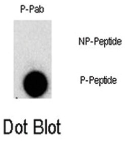 FGFR1 (phospho Y307), Rabbit anti-Human, Polyclonal Antibody, Abnova 400&mu;L;