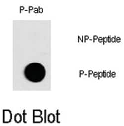 FOS (phospho T232), Rabbit anti-Human, Polyclonal Antibody, Abnova 400&mu;L;