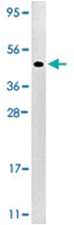 MAP2K1 (phospho S218/S222), Rabbit anti-Human, Polyclonal Antibody, Abnova 400 &mu;L | Buy Online | Abnova Corporation | Fisher Scientific
