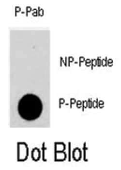 Abnova Corporation PKMYT1 (phospho T495), Rabbit anti-Human, Polyclonal Antibody, Abnova™